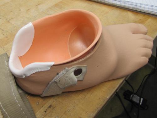 Partial Foot Prosthesis