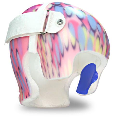Strategic Friction Reduction is an cranial remolding helmet